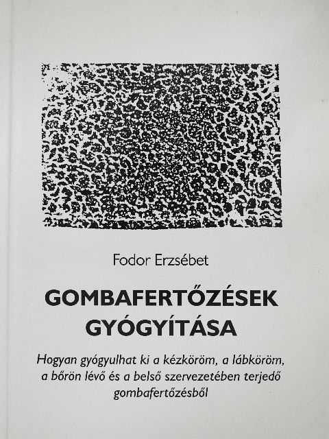 Fodor Erzsébet - Gombafertőzések gyógyítása [antikvár]