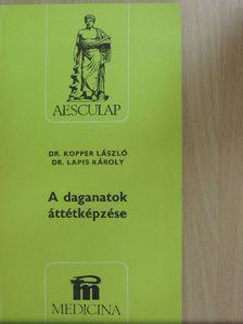 Dr. Kopper László - A daganatok áttétképzése [antikvár]