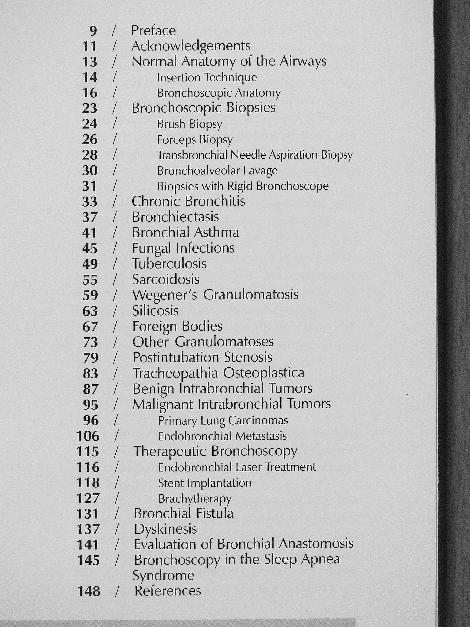 Barna Szima - Bronchoscopic Aspects of Human Lung Diseases [antikvár]