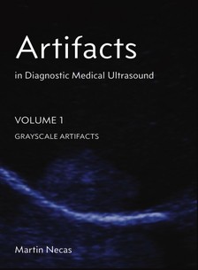Necas Martin - Artifacts in Diagnostic Medical Ultrasound [eKönyv: epub, mobi]