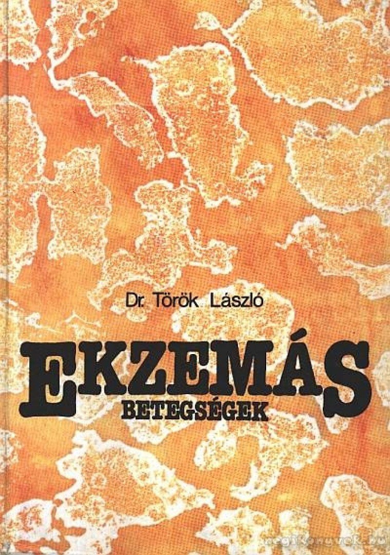 TÖRÖK LÁSZLÓ - Ekzemás betegségek [antikvár]