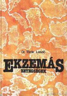 TÖRÖK LÁSZLÓ - Ekzemás betegségek [antikvár]