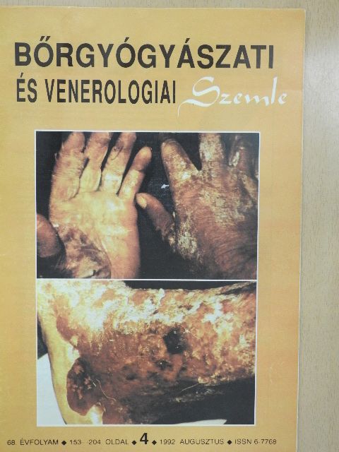 Dr. Kiss Zsuzsanna - Bőrgyógyászati és venerologiai szemle 1992. augusztus [antikvár]