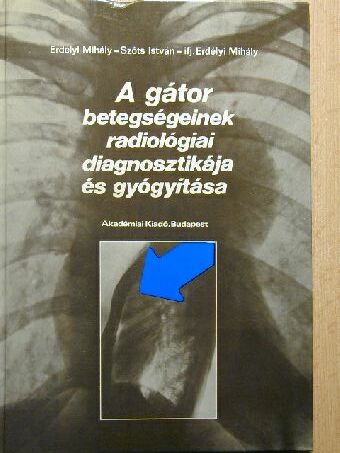 Erdélyi Mihály - A gátor betegségeinek radiológiai diagnosztikája és gyógyítása [antikvár]
