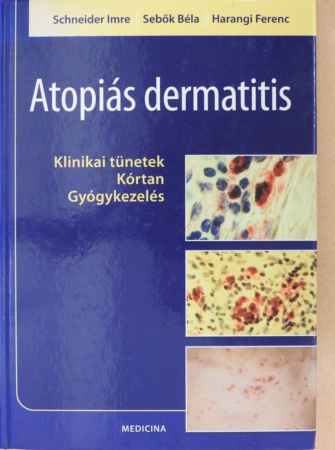 Harangi Ferenc - Atopiás dermatitis (dedikált példány) [antikvár]