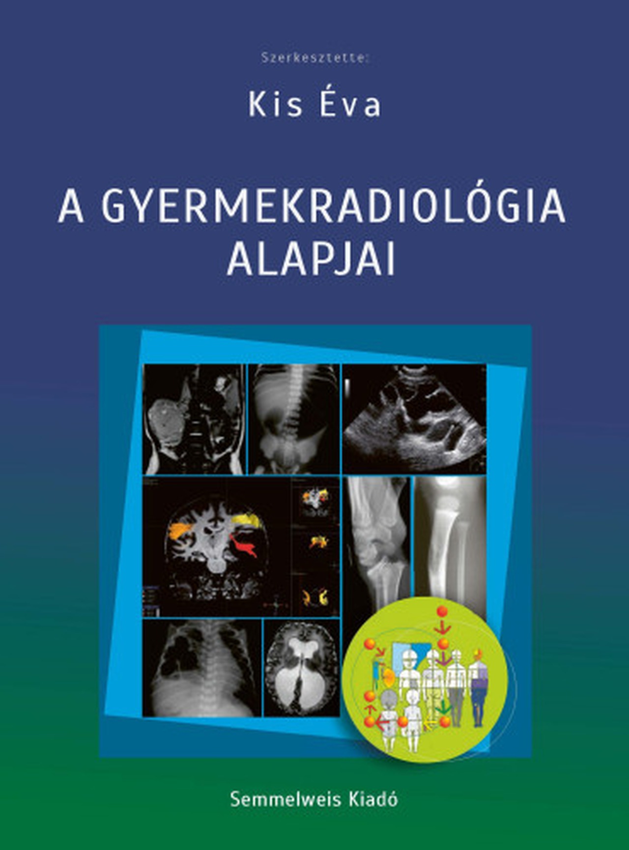 KIS ÉVA - A gyermekradiológia alapjai