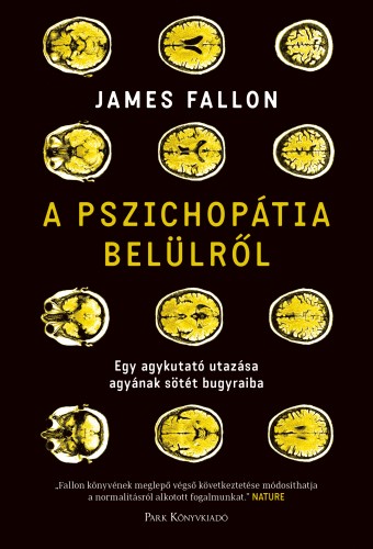 FALLON, JAMES - A pszichopátia belülről - Egy agykutató utazása agyának sötét bugyraiba [eKönyv: epub, mobi]
