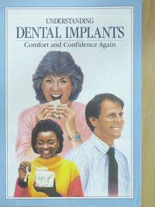 Understanding Dental Implants [antikvár]
