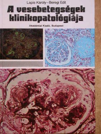 Beregi Edit - A vesebetegségek klinikopatológiája [antikvár]